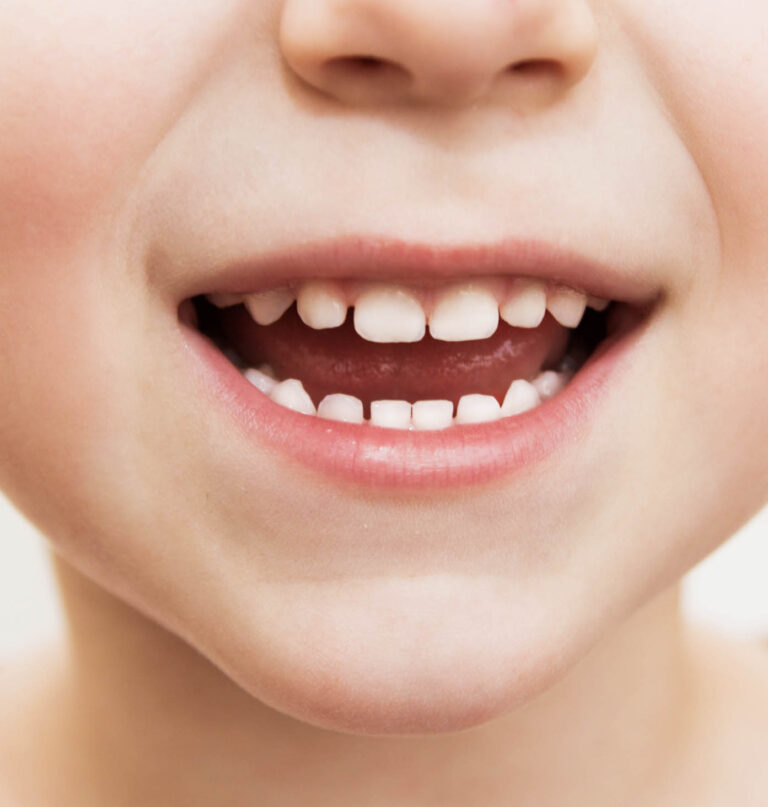 Молочные зубы — как растут и когда сменяются