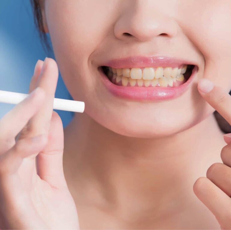 Влияние табакокурения на зубы