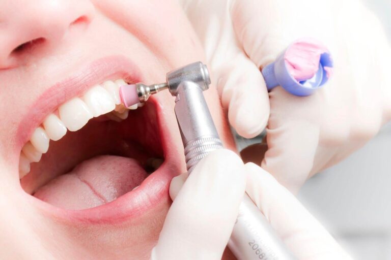 Процедура: Дентикюр (профессиональная гигиеническая чистка полости рта) — 6800 руб.