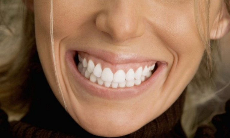 Как естественно улыбаться с зубами?