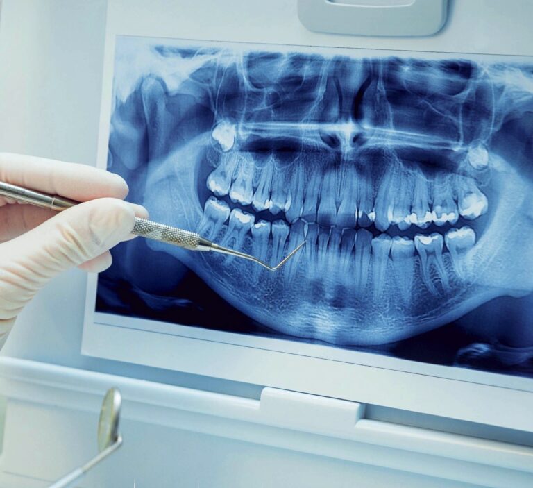 Современные методы исследования зубов