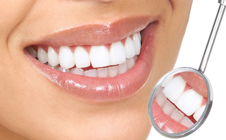 О винирах и здоровье зубов — интервью со стоматологом