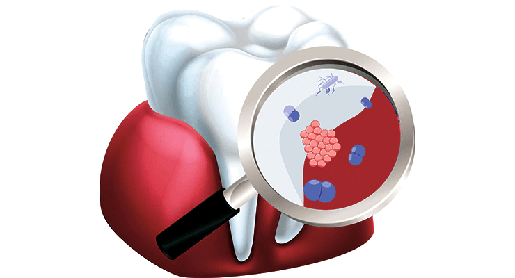 Гигиена рта — залог здоровья