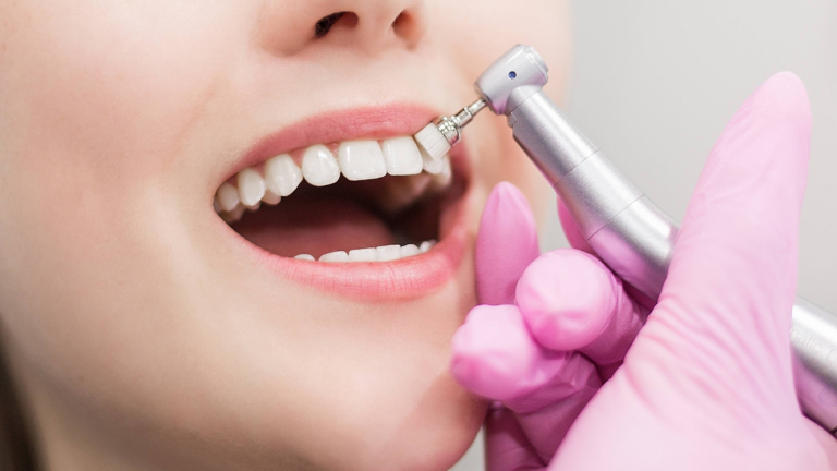 Процедура: Дентикюр (профессиональная чистка зубов) — 6800 руб.