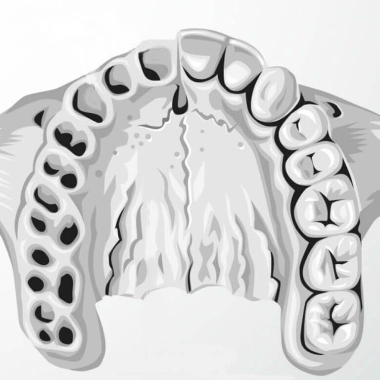 Стоматологический справочник: Альвеола зуба