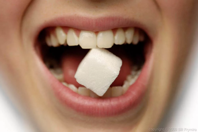 Особенности проявления сахарного диабета в полости рта